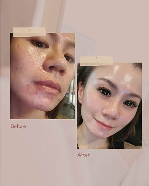 Skin transformation review by Meiwei