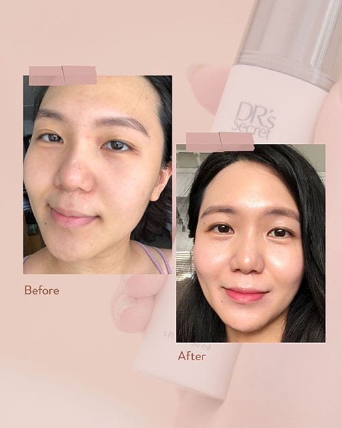 Skin transformation review by Pheuron