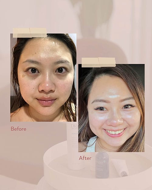 Skin transformation review by Summer